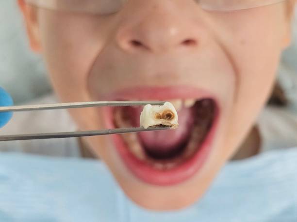 Best Emergency Broken Tooth Repair in Fernley, NV